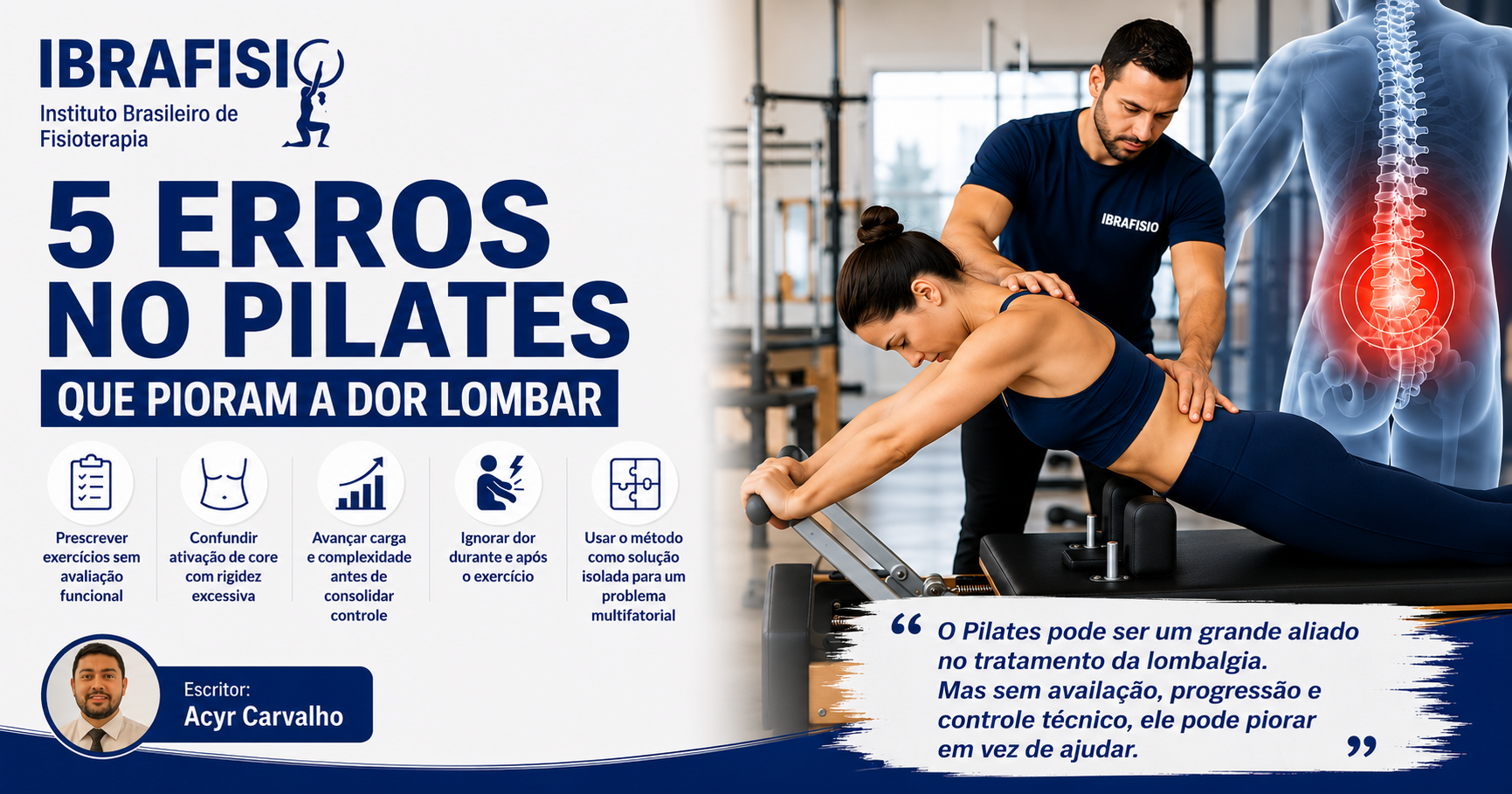 5 erros no Pilates que pioram a dor lombar